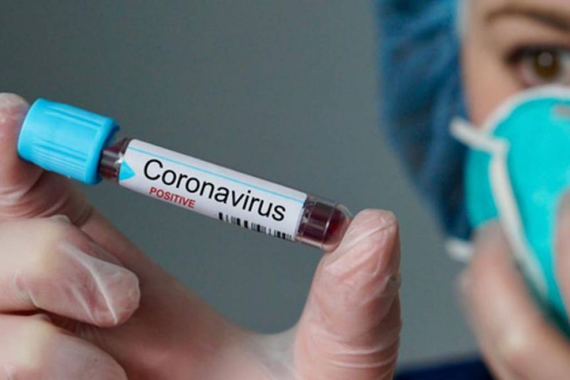 Photo of Primeiro caso confirmado de coronavírus em Querência