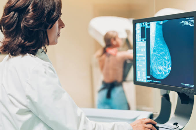 Photo of Câncer de mama aumenta em mulheres com menos de 40 anos