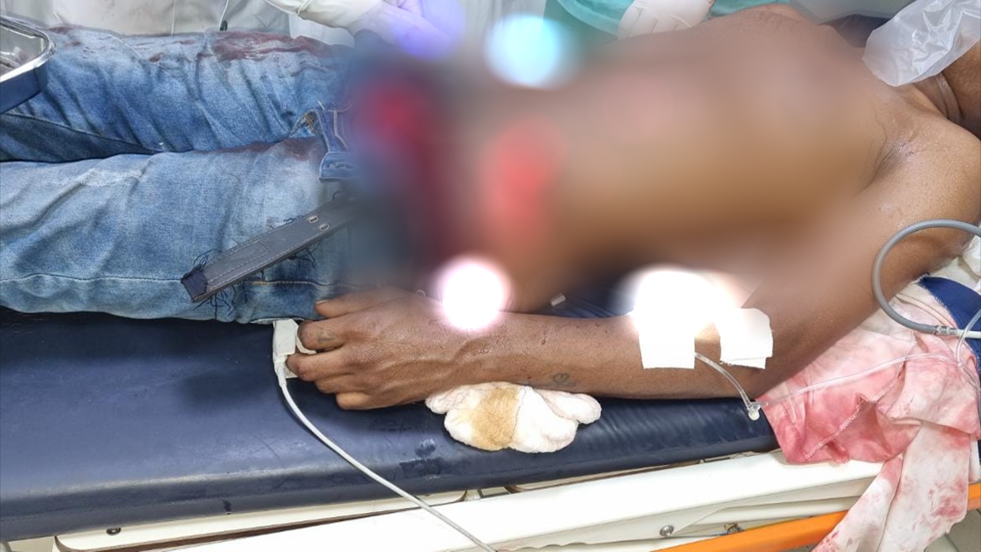 Photo of Querência – Homem sofre 3 facadas e é encaminhado para o Hospital Municipal