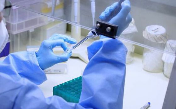 Photo of Testes tipo PCR para varíola dos macacos podem ter início na próxima semana