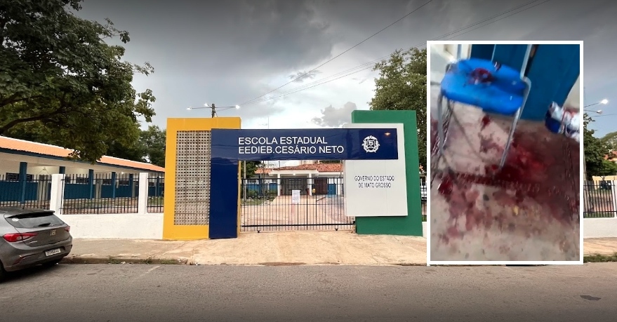 Photo of Atualizada- Estudante usou caneta para furar pescoço de colega em escola em Cuiabá