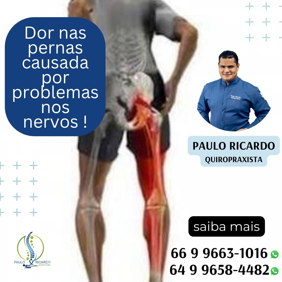 Photo of Dor nas pernas causada por problemas nos nervos – Quiropraxista Paulo Ricardo