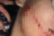 Photo of Querência – Mulher é agredida e tem o rosto cortado pelo companheiro em zona rural