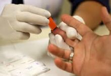 Photo of JULHO AMARELO: Mato Grosso reduz mortes por hepatite C em 50% e avança no enfrentamento da hepatite B