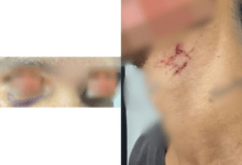 Photo of Goiânia: Denarc prende suspeito e resgata homem mantido em situação de exploração sexual