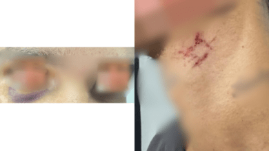 Photo of Goiânia: Denarc prende suspeito e resgata homem mantido em situação de exploração sexual