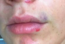 Photo of Homem é preso em flagrante por agredir companheira a pauladas em Água Boa
