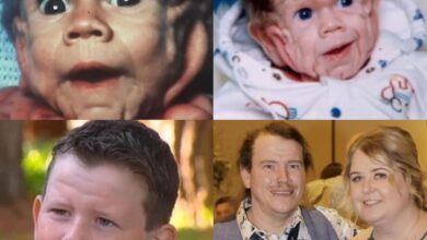 Photo of “Da ficção à realidade: caso raro que lembrou ‘O Curioso Caso de Benjamin Button’ inspira história de superação”